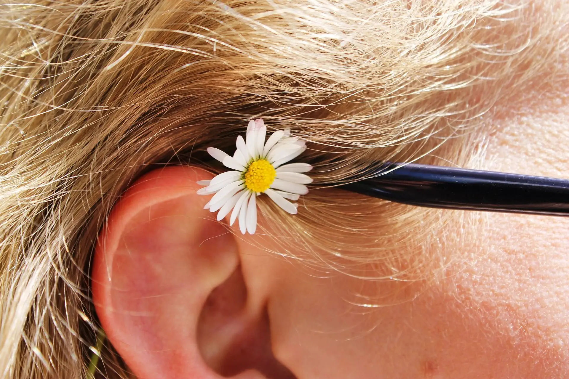 Oreja sin otoplastia