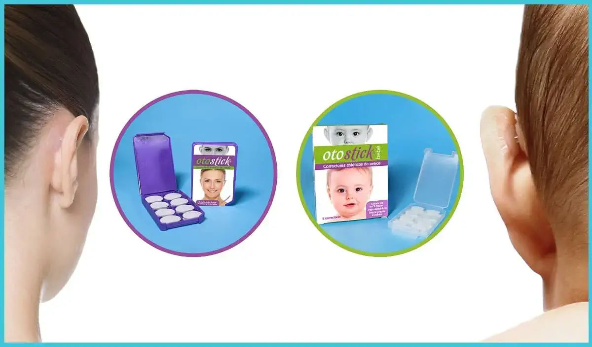 Otostick Baby Aesthetic Discreet Ear Corrector for Prominent Ears from 3  Months of Age - English Box 