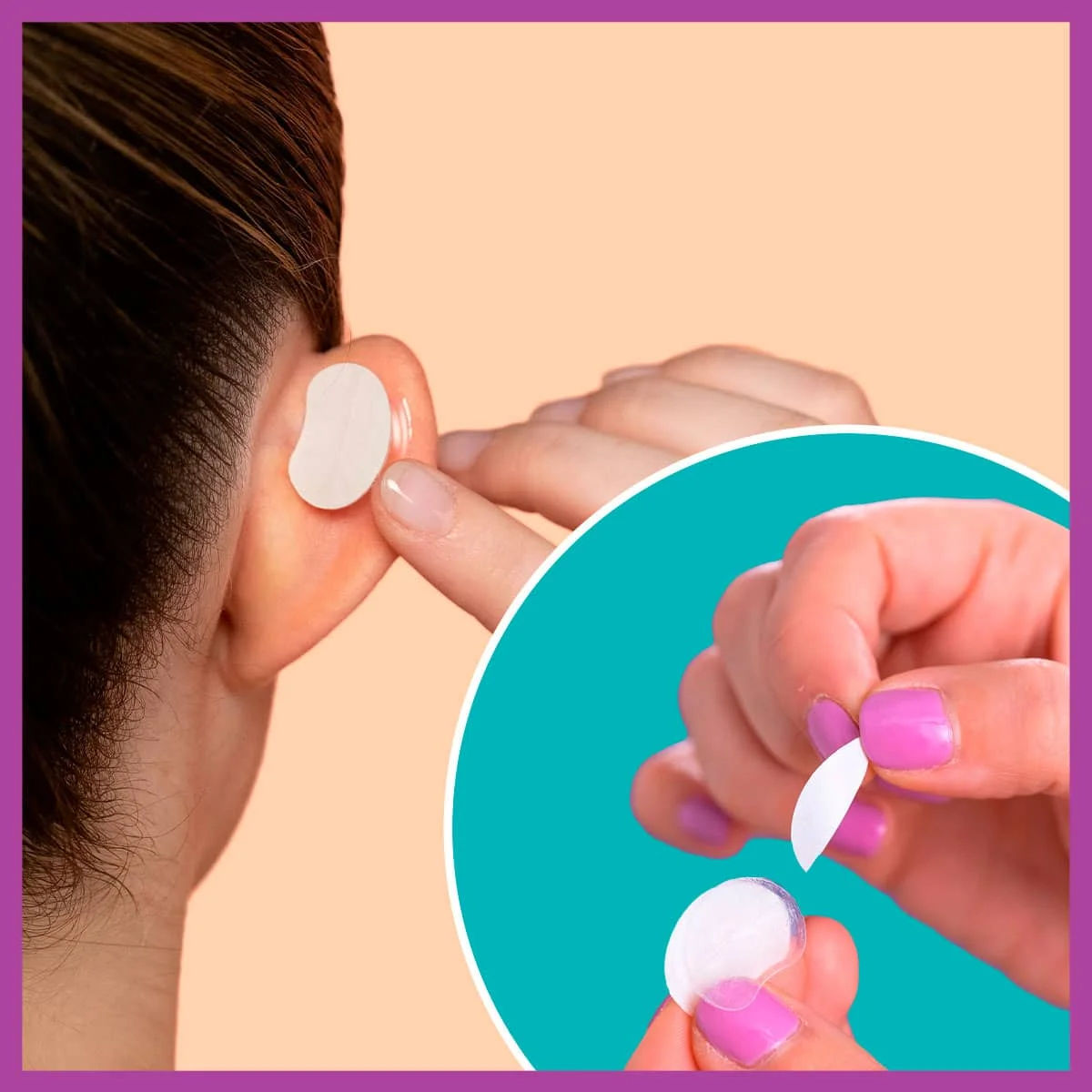 Otostick - 8 unidades de corrector de oído discreto cosmético sobresaliente  - Productos correctivos para el cuidado del oído para fijación de oídos