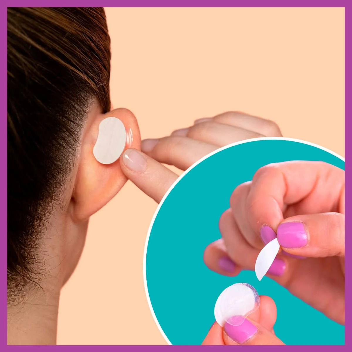 otostick - Otostick Bebé proporciona una posición óptima de la oreja y del  cartílago, para que el desarrollo del mismo sea el adecuado. 👂👶 Gracias a  sus características, se adapta perfectamente a