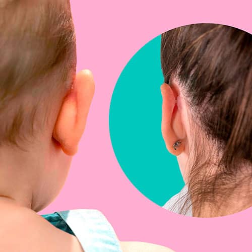 otostick - Los correctores Otostick y Otostick Bebé están fabricados con  silicona transparente y se fijan a la piel mediante adhesivos sanitarios.  👂👶🙋‍♀️ Tienen un papel protector de color blanco que debes