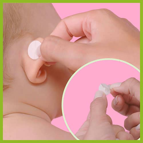 otostick - Los correctores Otostick y Otostick Bebé están fabricados con  silicona transparente y se fijan a la piel mediante adhesivos sanitarios.  👂👶🙋‍♀️ Tienen un papel protector de color blanco que debes