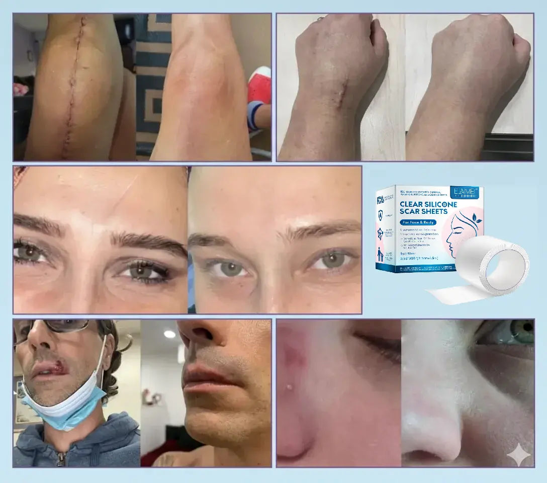 Customer success story