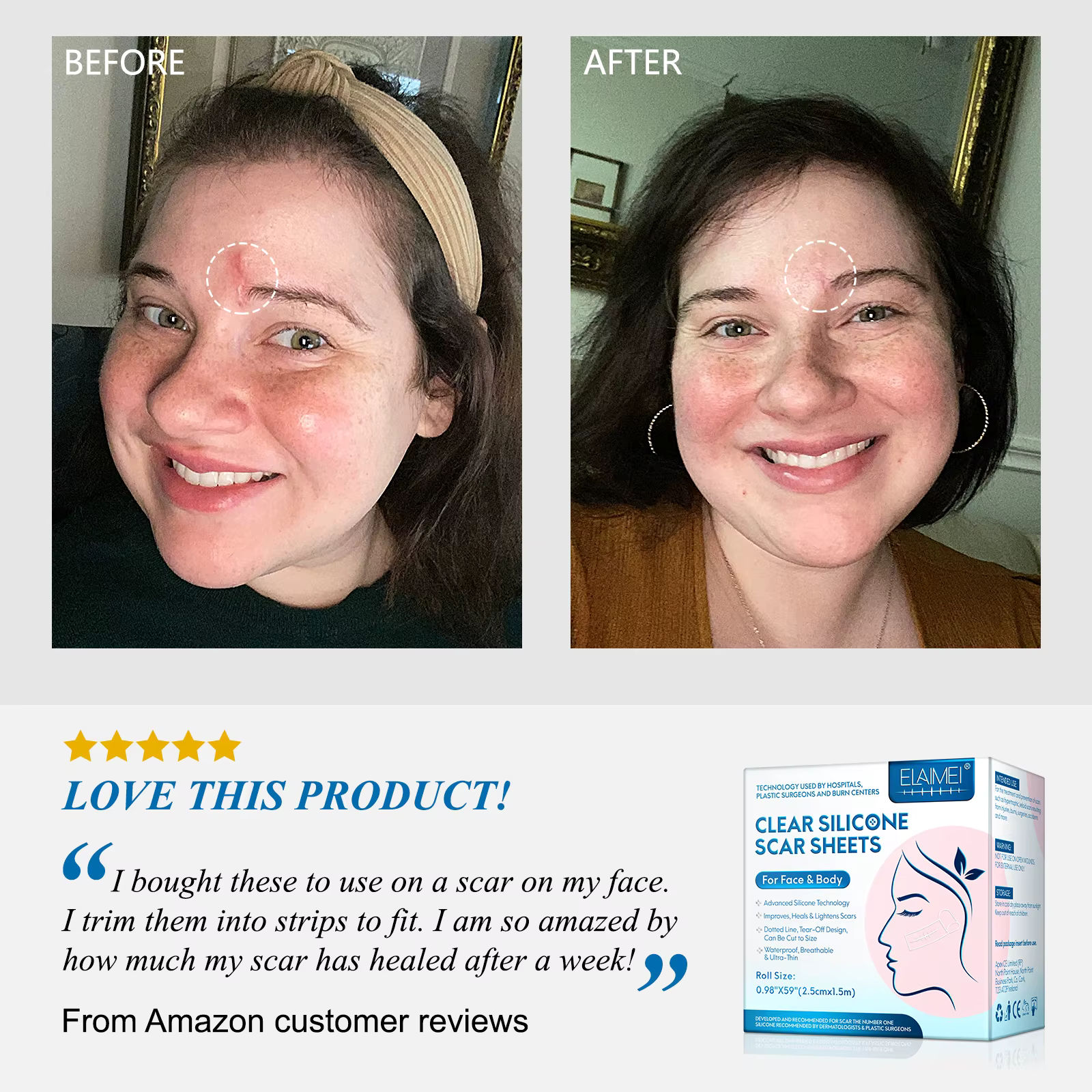 Close-up of micro-dart scar patch