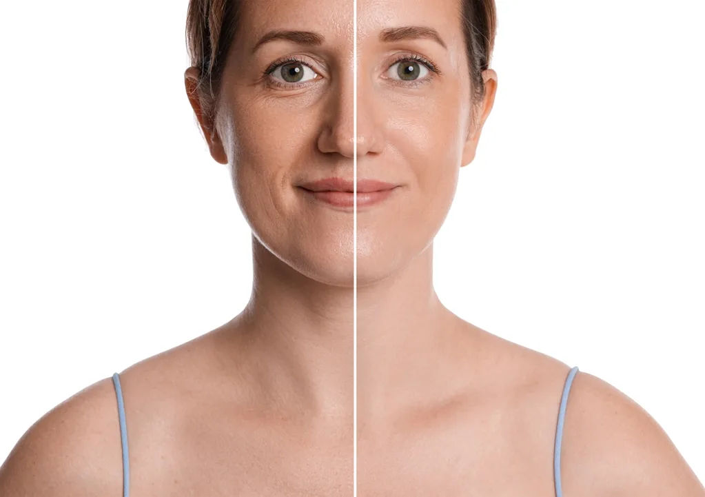 Acne treatment consultation at MySkindom, a skin clinic in Kalyan