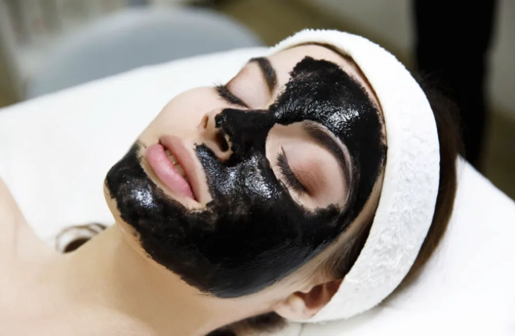 Carbon Facial in Kalyan - activated carbon mask applied before the laser pass at MySkindom