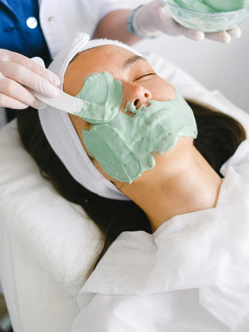chemical-peel