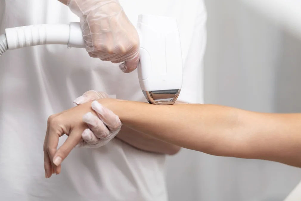 Laser hair reduction session in progress at MySkindom, Kalyan