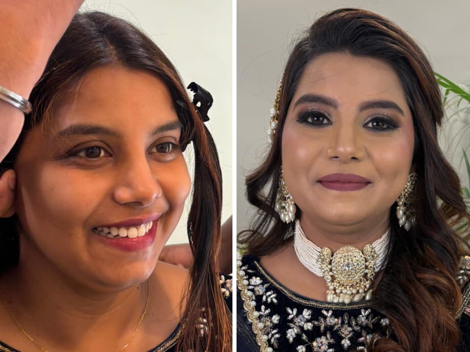 skin before after