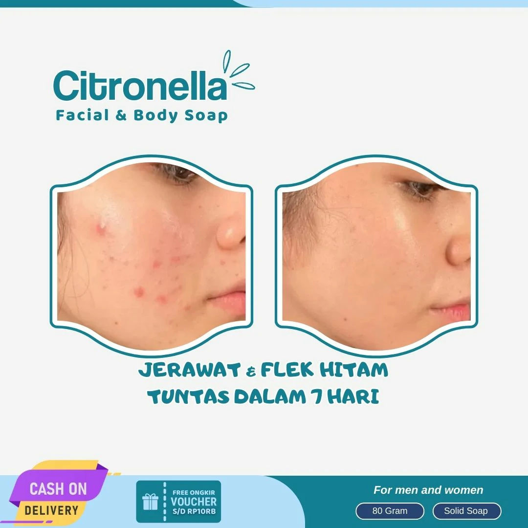 Jual Sabun Muka Citronella Original Termurah Batang