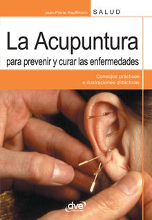 La acupuntura para prevenir y curar las enfermedades.  Jean-Pierre Kauffmann