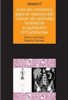 Gua de consenso para el manejo del cncer de prstata resistente a castracin en Catalunya.  MaraJosRibalCaparrs 