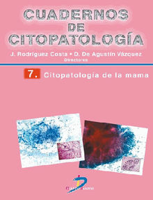 Citopatologa de la mama.  Mercedes Santamara Martnez