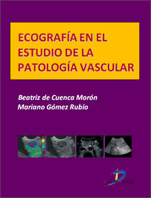 Ecografa en el estudio de la patologa vascular.  Mariano Gmez Rubio