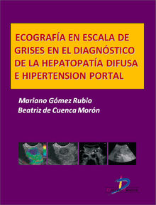 Ecografa en escala de grises en el diagnstico dela hepatopata difusa e hipertensin portal.  Mariano Gmez Rubio