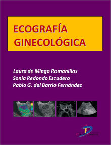 Ecografa ginecolgica.  Sonia Redondo Escudero