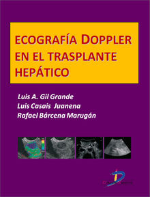 Ecografa Doppler en el trasplante heptico.  Luis Gil Gande