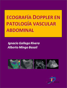 Ecografa Doppler en Patologa vascular abdominal.  Alberto Mingo Basail