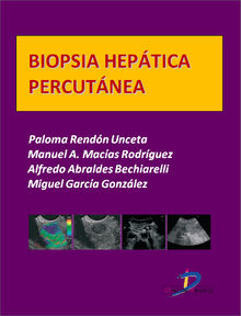 Biopsia heptica percutnea.  Paloma y cols. Rendn Unceta