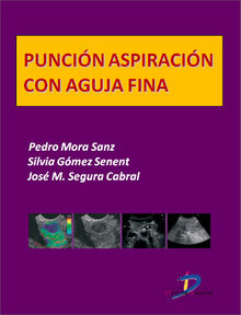 Puncin aspiracin con aguja fina.  Jos M. Segura Cabral