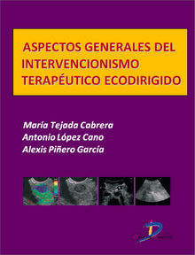 Aspectos generales del intervencionismo teraputico Ecodirigido.  Mara Tejada Cabrera