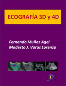 Ecografa 3D y 4D.  Modesto J. Varas Lorenzo