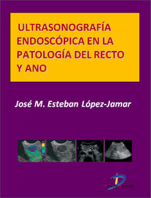 Ultrasonografa endoscpica en la patologa del recto y ano.  Jose M. Esteban Lpez Jamar