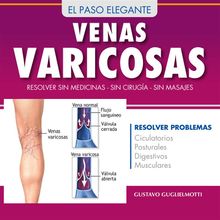 Venas Varicosas - Solucin definitiva.  Gustavo Guglielmotti