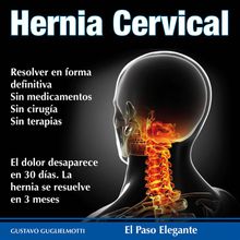 Hernia cervical.  Gustavo Guglielmotti