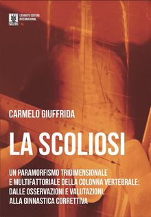 La Scoliosi.  Carmelo Giuffrida