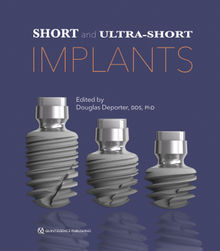 Short and Ultra-Short Implants.  Douglas Deporter