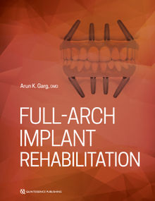 Full-Arch Implant Rehabilitation.  Arun Garg