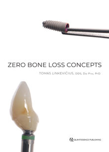 Zero Bone Loss Concepts.  Tomas Linkevi?ius