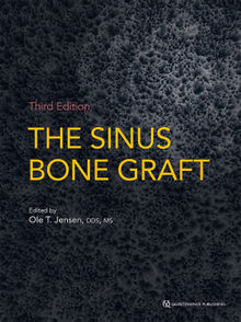 The Sinus Bone Graft.  Ole T. Jensen