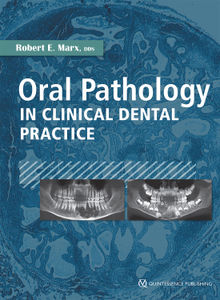 Oral Pathology in Clinical Dental Practice.  Robert E. Marx