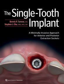 The Single-Tooth Implant:.  Dennis P. Tarnow