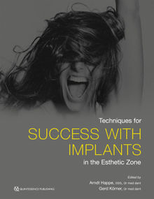 Techniques for Success With Implants in the Esthetic Zone.  Gerd Krner