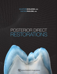 Posterior Direct Restorations.  Salvatore Scolavino