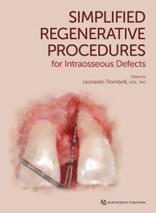 Simplified Regenerative Procedures for Intraosseous Defects.  Leonardo Trombelli