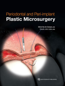 Periodontal and Peri-implant Plastic Microsurgery.  Cludio Julio Lopes