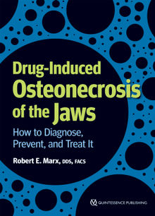 Drug-Induced Osteonecrosis of the Jaws.  Robert E. Marx