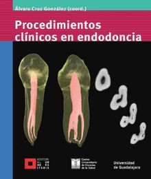 Procedimientos clnicos en endodoncia.  Francisco Yez Lpez