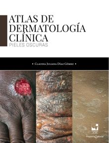 Atlas de dermatologa clnica.  Claudia Juliana Daz Gmez