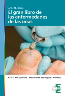 El gran libro de las enfermedades de las uas.  Anke Niederau