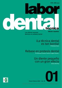 Labor Dental Tcnica N1 Vol.25. S.l. Ediciones Especializadas Europeas