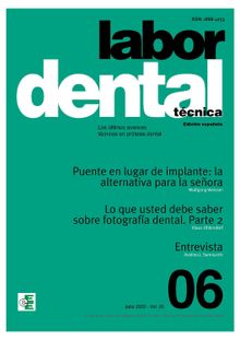 Labor Dental Tcnica N6 Vol.25. S.l. Ediciones Especializadas Europeas