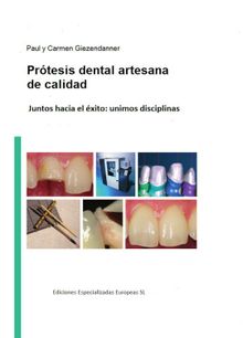 Prtesis dental artesanal de calidad.  Eee Labor Dental