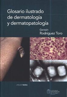 Glosario ilustrado de dermatologa y dermatopatologa.  Gerzan Rodrguez Toro