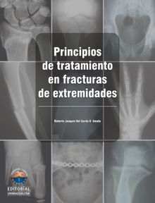 Principios de tratamiento en fracturas de extremidades.  Roberto Joaqun Gordo Del DAmato