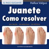 JUANETE - RESOLVER SIN CIRUGA